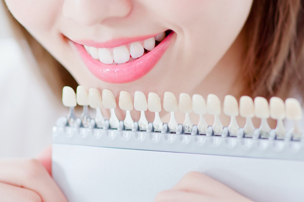 Teeth whiten concept